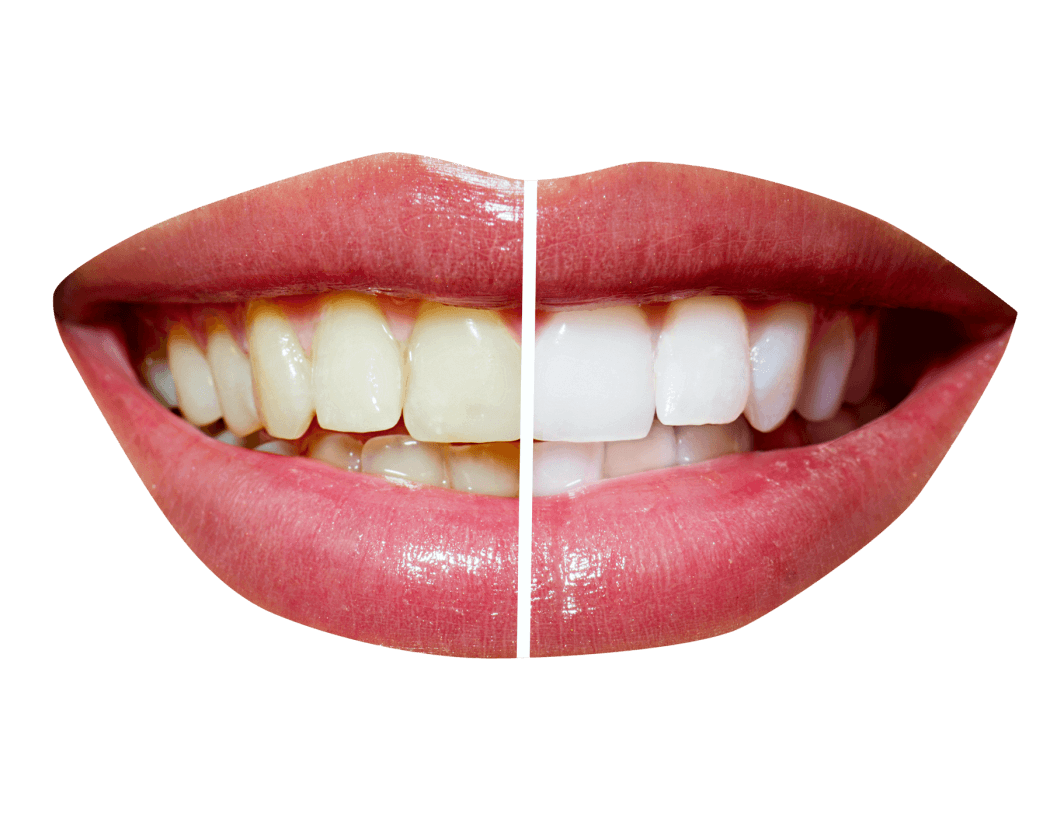 Эстетическая стоматология