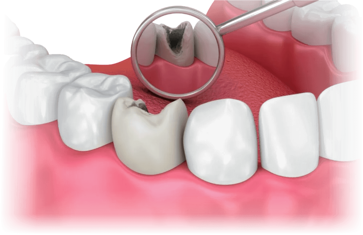 Терапевтическое лечение